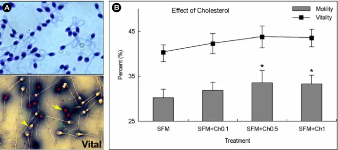 Figure 2. Analysis of  sperm motility and viability. A) Upper panel: count and morphology analysis using 0.75% 