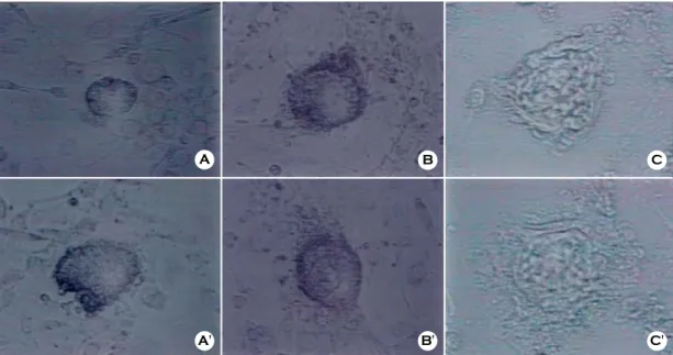 Figure 3. ICM colony formed on STO and pMEF feeder layer after 5 days of  culture by three different ICM isolation  methods