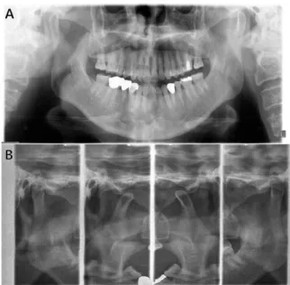 Fig. 1. radiographic findings. A. panoramic view, B.