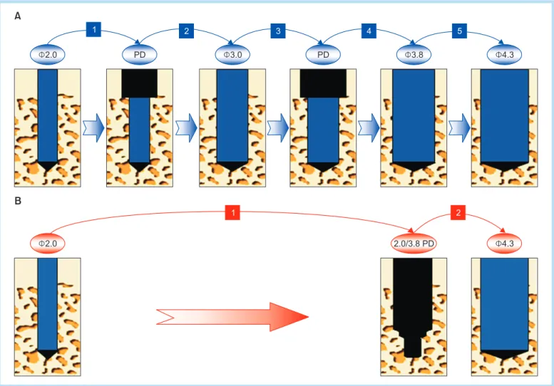 Fig. 2.  Schematic drawing showing drilling sequence performed in this study for diameter 4.3 mm