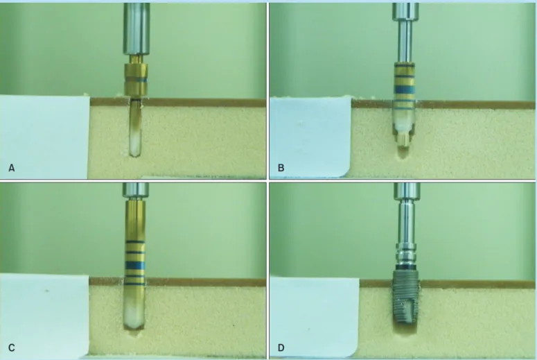 Fig. 5.  Experimental drilling sequence for diameter 4.6 mm with multi-step drill. (A) Diameter 2.0 mm twist drill; (B) MD2043  multi-step drill; (C) diameter 4.6 mm twist drill; (D) diameter 5.0 mm fixture.