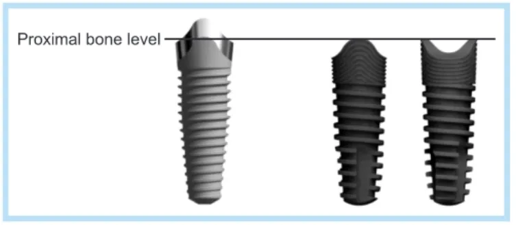 Table 1.  Used implants
