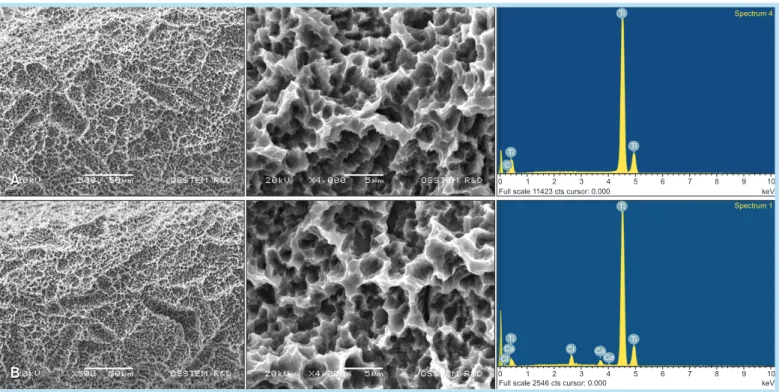 Fig. 1.  The surface topography (×500) and energy-dispersive X-ray spectroscopy (×4,000) of the SA (A) and CA (B)  surface