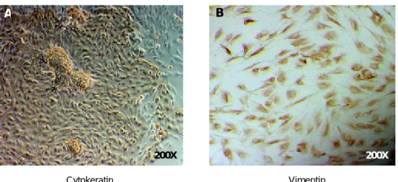Figure 2. Immunocytochemical staining of primary cultures of  human endometrial epithelial (A) and stromal (B) cells