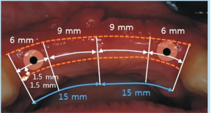 Fig. 3. 	Cone­beam	computed	tomography	view.	(A)	Three­dimensional	view.	(B)	Cross	sectional	view	of	maxillary	right	 lateral	incisor.	(C)	Cross	sectional	view	of	maxillary	left	lateral	incisor.