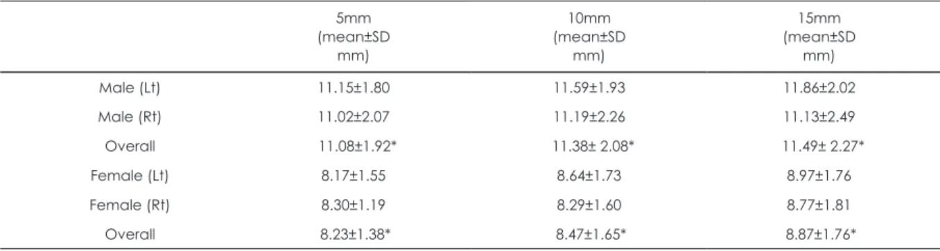 Table 1. Mean averages of frontal sinus depth comparing at 5mm, 10mm, 15mm from the midline (straight line passing through the  crista galli)