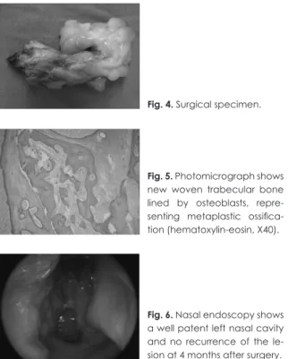 Fig. 4. Surgical specimen.