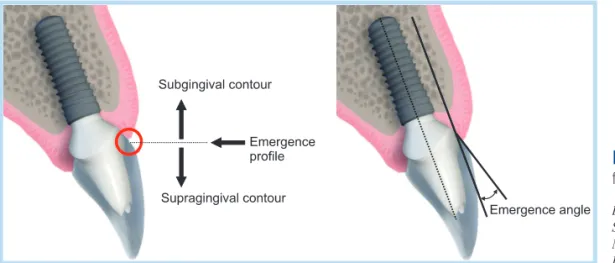 Fig. 1. 	Definition	of	emergence	pro- 	Definition	of	emergence	pro-file	and	emergence	angle.