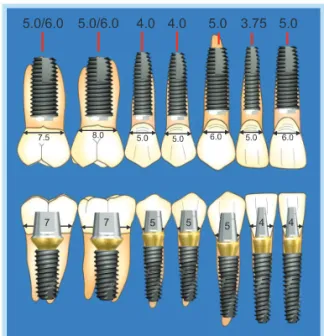 Fig.  2. 	 Selection	 of	 fixture	 and	 abutment	 diameter	 considering	natural	tooth	form.