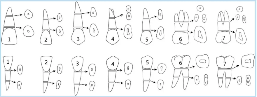 Fig. 7. 	Computer	aided	design/computer	aided	man- 	Computer	aided	design/computer	aided	man-ufacturing	(CAD/CAM)	abutment	and	stock	abutment.