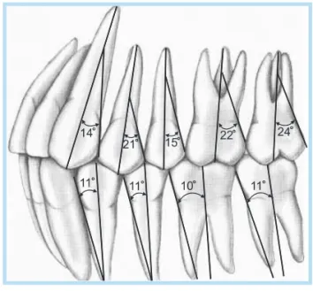 Fig. 11. 	Emergence	angle	changes	 of	 impant	 abutment	 according	 to	 collar	height.