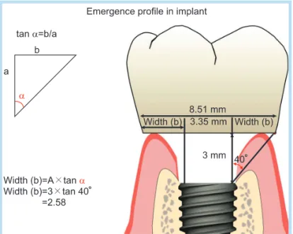 Fig. 13. 	Running	room	in	various	 implant	systems.	