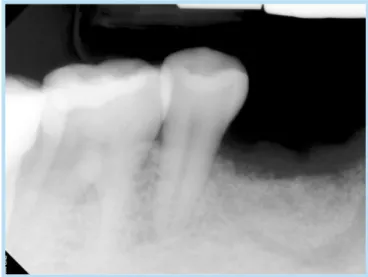 Fig. 8. 	At	6	months	after	surgery,	soft	tissue	healed	 completely.