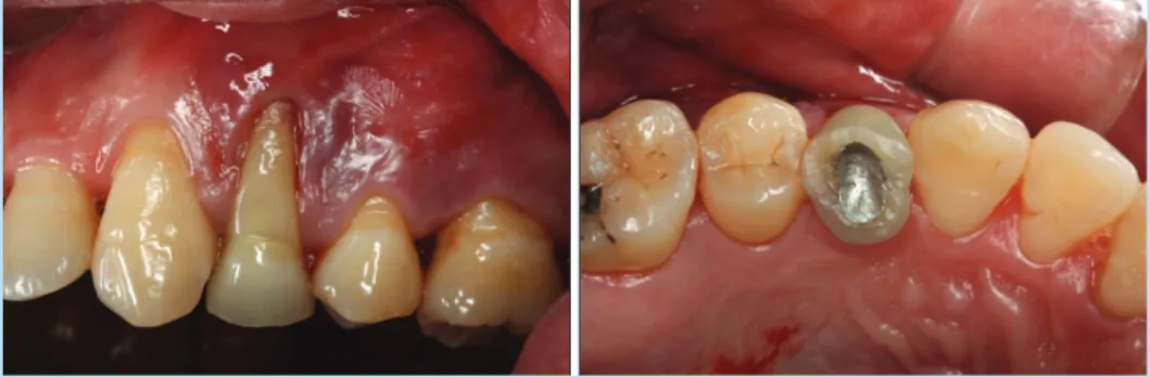 Fig. 11. 	Clinical	photos	at	first	visit.