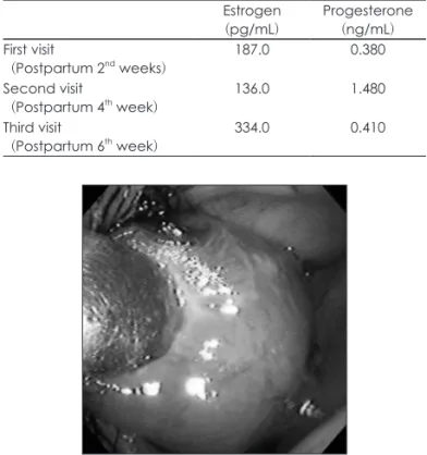 Table 1. The post partum change of estrogen and progesterone Estrogen (pg/mL) Progesterone(ng/mL) First visit   (Postpartum 2 nd  weeks) 187.0 0.380 Second visit   (Postpartum 4 th  week) 136.0 1.480 Third visit   (Postpartum 6 th  week) 334.0 0.410