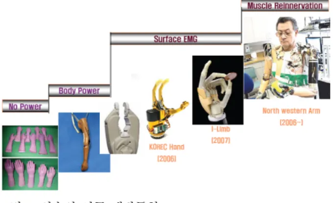 Fig.    1. Trend of the prosthetic hand development for the upper limb  amputee. 