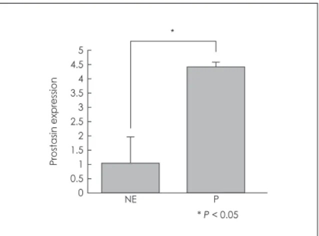 Fig. 2. Immunohistochemical localization of prostasin in normal  nasal ethmoid sinus mucosa (A) and nasal polyp (B)