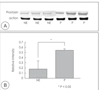 Fig. 3. Examination of protein production. Western blot analysis  of  prostasin  in  normal  normal  ethmoid  sinus  mucosa  and   na-sal polyp(A)