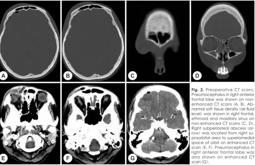 Fig. 2. Preoperative CT scans. 