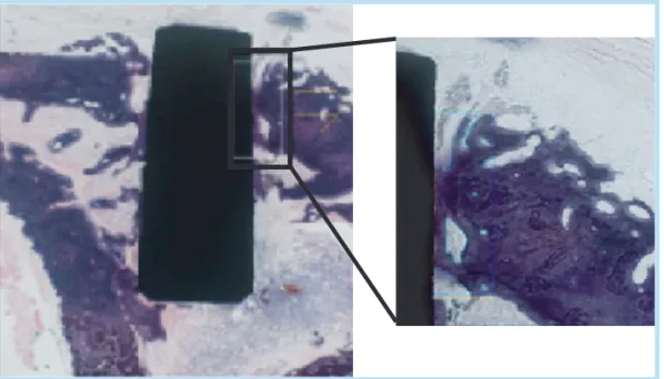 Fig. 3.  Image analysis of a non- non-decalcificied tissue with the implant  (H&amp;E, ×100)