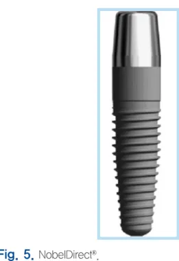 Fig. 4.  NobelDirect ®  3.0.
