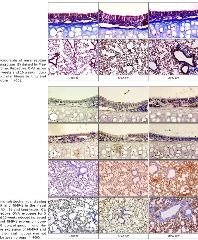 Fig. 5. Micrographs of nasal septum (A) and lung tissue (B) stained by  Mas-son trichrome