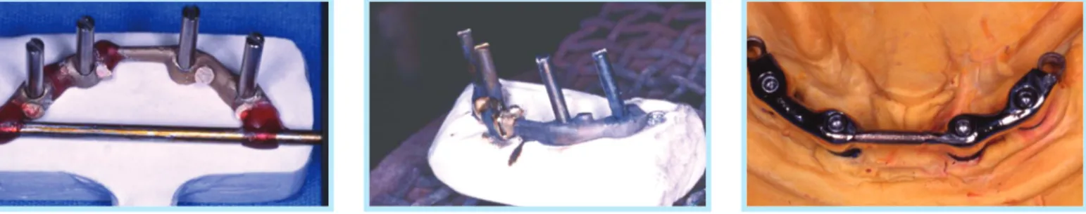 Fig. 4.  Framework cutting and soldering.  