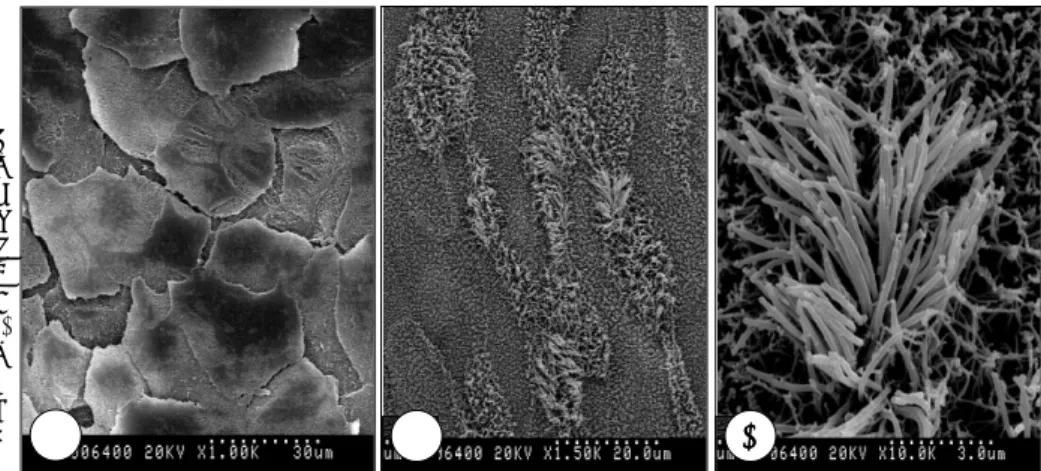 Fig. 3. Scanning electron microscopic findings. NHNE cells were cultured in RA-deficient media for 14 days at the air-liquid interface