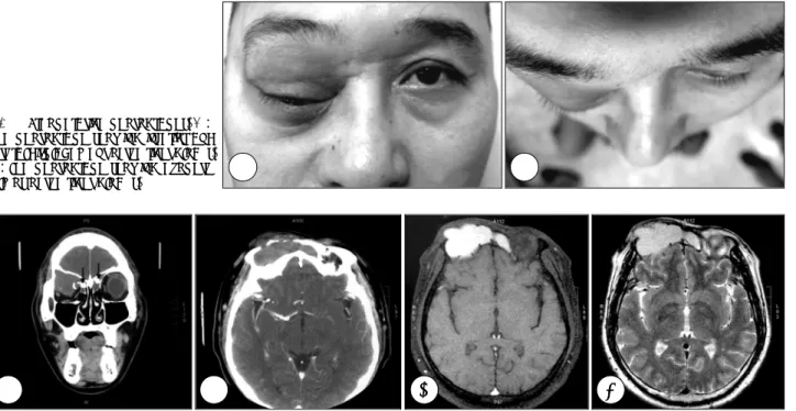 Fig. 1. Preoperative photographs. A：