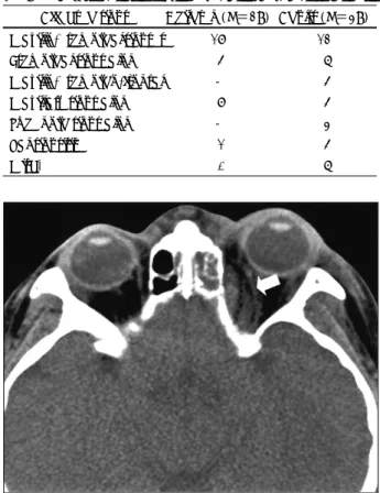 Table 2. Affected sinuses in the pediatric and adult patients  Affected sinus  Children (N＝29) Adults (N＝39)  Maxillo-ethmoidal sinuses  17  12  Ethmoidal sinus alone    4    6 