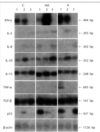 Table 3. Number  of  subjects  with  positive  band  on  Southern blot analysis of amplified cDNA 