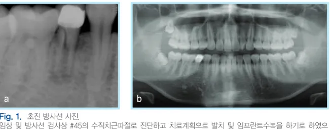 Fig. 2.   술전 임상 사진.