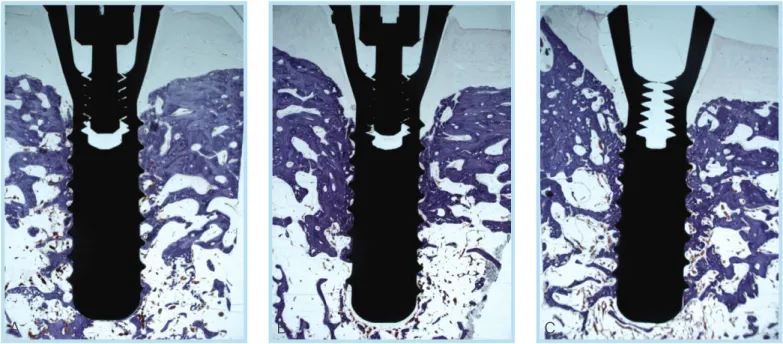 Figure 6.  Histologic view of the 1.0mm(A) &amp; 1.5mm(B) &amp; 2.0mm(C) Gap defect with Non-submerged type implant