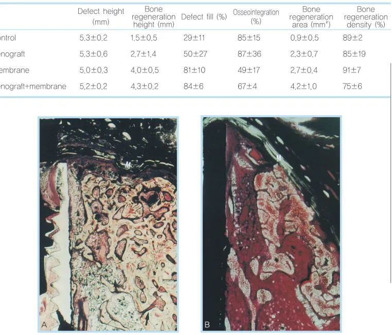 Table 10.  Comparion of various regenerative procedure in dehiscence defect