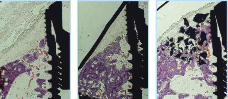 Figure  8.  Comparsion  among  the  defect  with  resorbable  membrane(A)  and  the  defect  with  non-resorbable membrane(B) and the defect with bone graft material + barrier membrane(C)