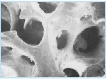 Fig. 16.  Biphasic calcium phosphate surface