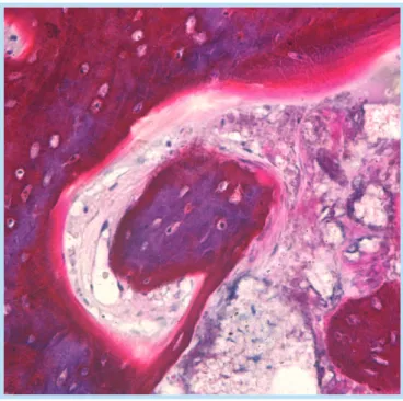 Fig. 10.  Case 1 / Date : 2006. 05 / Period : 7.5 months / Site : #16 / H&amp;E staining / x400 magnification