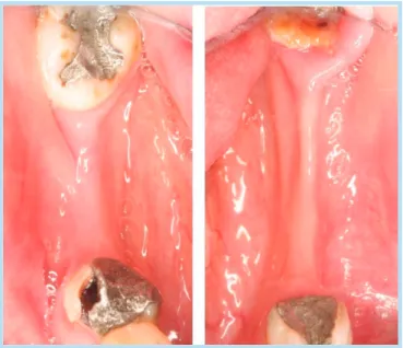 Fig. 2.  Preoperative panoramic radiograph.