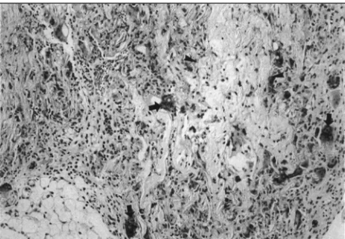 Fig. 2. Maxillary sinus mucosa of the rabbit showing mild muc- muc-osal thickening (arrow) 8 weeks after 25mg of PLA polymer insertion