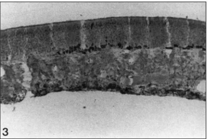 Fig. 4. Schematic illustration of distribution pattern of PCNA- PCNA-positive epithelial cells in normal nasal septal mucosa