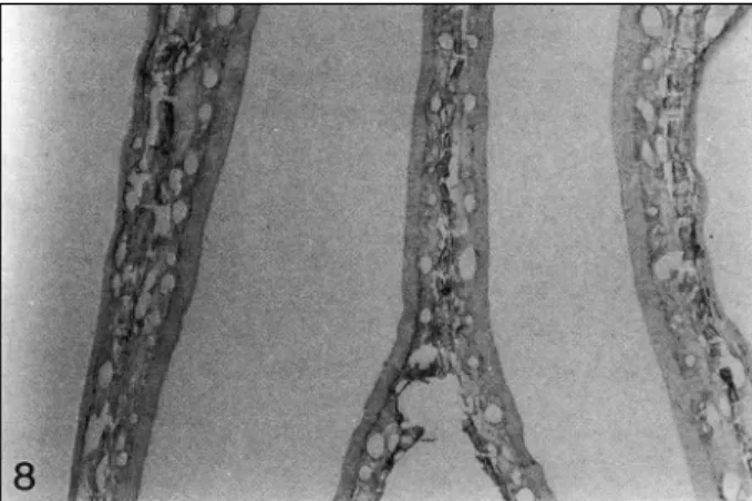 Fig. 8. The coronal section of nasal mucosa of the turbinates and lateral wall of nasal cavity at the level of olfactory epithelium.