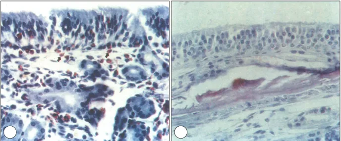 Table 2. Scanning electron microscopic features of allergy and  control group in nasal epithelia in rats 