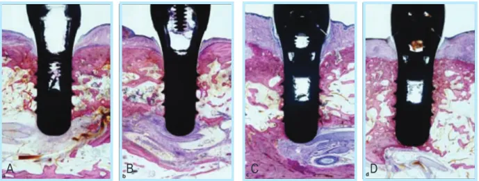 Fig. 3.  Quinlan’ s histologic cross-sections of implants from a) Group A : 3months, b) Group B : 21 days, c) Group C : 10 days, d) Group D : 2 days after 3 months of loading 68) .