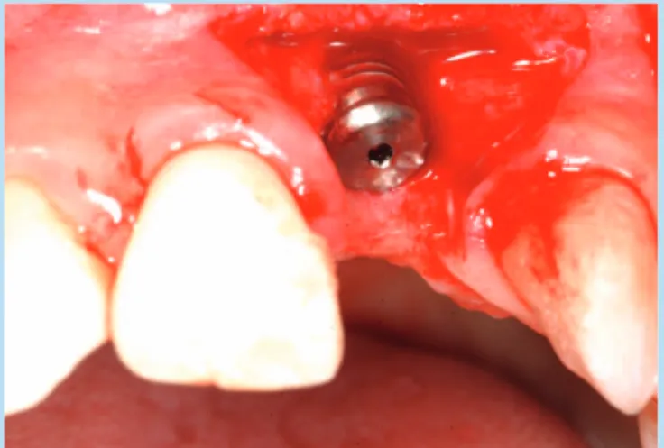 Fig. 25.  Preoperative intraoral view