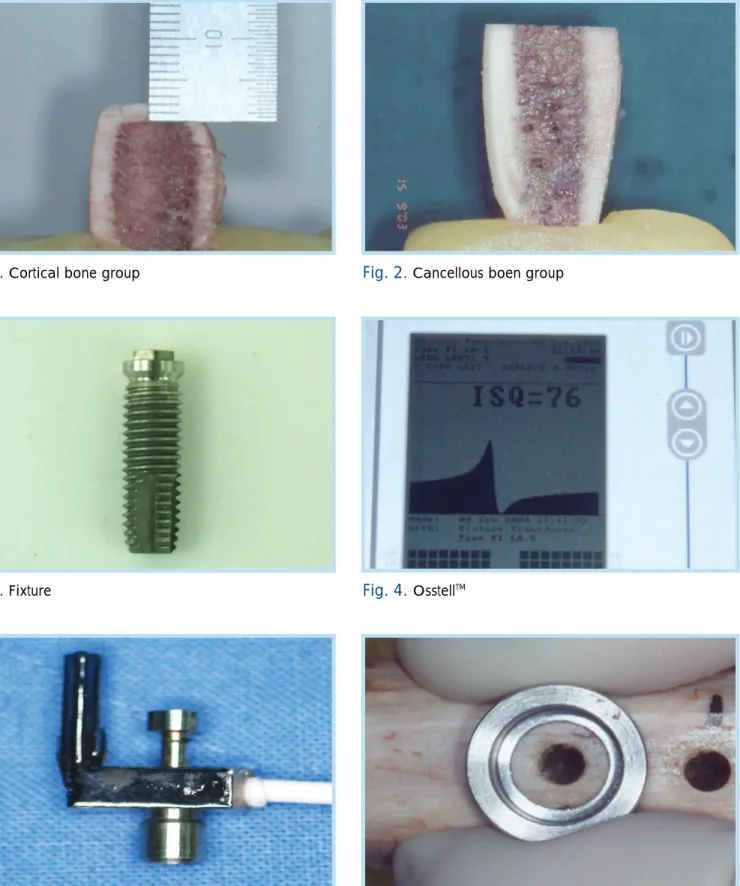 Fig. 3.  Fixture Fig. 4.  Osstell TM