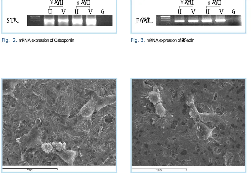 Fig.  2.  mRNA expression of Osteopontin 
