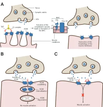Figure 2. Effector mechanisms of Anti-Ach receptor antibody. 