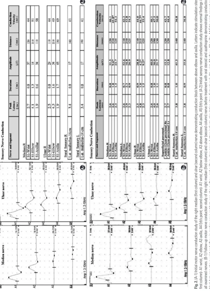 Fig. 2. (A-1) Initial motor nerve conduction study of the right median (first column) and ulnar (second column) nerve demonstrating conduction block between above elbow and axilla