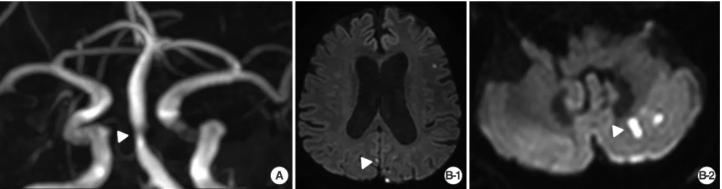 Fig. 1. Brain MR imaging of the patient with acute unilateral vestibulo-cochlear syndrome
