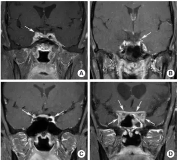 Fig. 11. Examples of inflammatory disorders affecting cranial nerve diagnosed  by high-resolution image